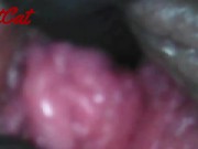 Preview 5 of Endoscopic ♥vaginal observation