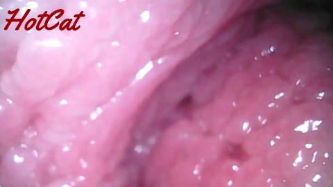 Endoscopic ♥vaginal observation