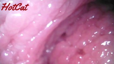 Endoscopic ♥vaginal observation内視鏡おまんこ♥膣内観察