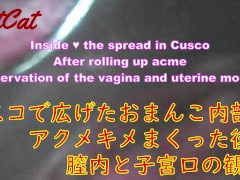 クスコで広げたおまんこ内部♥ アクメキメまくった後の 膣内と子宮口の観察 - Screenshot 1 of 16 - 子宮口
