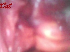 クスコで広げたおまんこ内部♥ アクメキメまくった後の 膣内と子宮口の観察 - Screenshot 10 of 16 - 観察