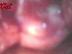 クスコで広げたおまんこ内部♥ アクメキメまくった後の 膣内と子宮口の観察