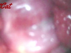クスコで広げたおまんこ内部♥ アクメキメまくった後の 膣内と子宮口の観察 - Screenshot 13 of 16 - 膣内