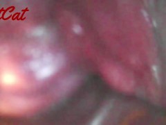 クスコで広げたおまんこ内部♥ アクメキメまくった後の 膣内と子宮口の観察 - Screenshot 14 of 16 - 女性器