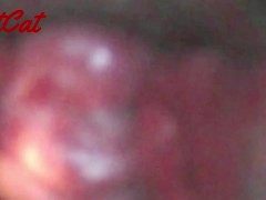 クスコで広げたおまんこ内部♥ アクメキメまくった後の 膣内と子宮口の観察 - Screenshot 15 of 16 - 観察