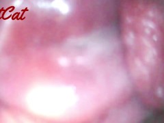 クスコで広げたおまんこ内部♥ アクメキメまくった後の 膣内と子宮口の観察 - Screenshot 3 of 16 - 膣内