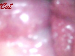 クスコで広げたおまんこ内部♥ アクメキメまくった後の 膣内と子宮口の観察 - Screenshot 6 of 16 - 子宮口