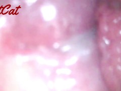 クスコで広げたおまんこ内部♥ アクメキメまくった後の 膣内と子宮口の観察 - Screenshot 7 of 16 - クスコ