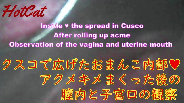Binnen ♥ De Spread in Cusco Na Het Oprollen Van Acme Observatie Van De Vagina En Baarmoedermond