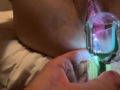 Diabetes girl gets Doggy style creampie with speculum scooping up cum for her to taste.