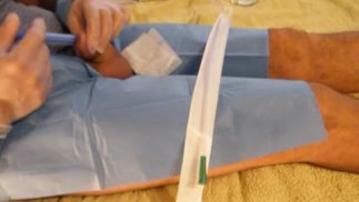 KORREKTES VERFAHREN ZUM EINFÜHREN DES KATHETERS