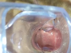 Especulo anal