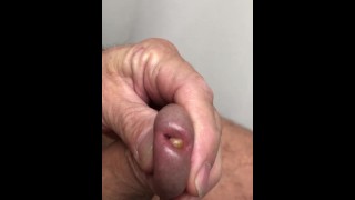 Penis bevalt van popcornpit