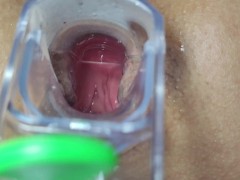 I continue with my speculum in my ass