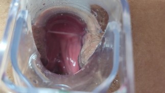 I continue with my speculum in my ass