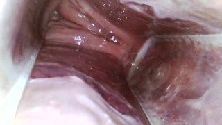 Free 内視鏡 Porn Videos, page 8 from Thumbzilla