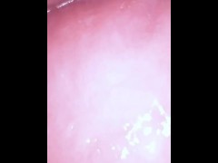 Omanko Endoscope