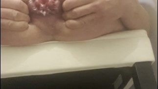 抽出我的脱垂