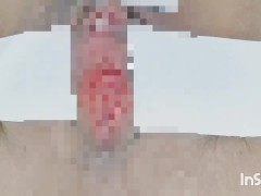 I used adhesive to expose the clitoris. 🌟