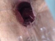 Preview 2 of Speculum Pussy Close up Inside My Pussy