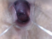 Preview 3 of Speculum Pussy Close up Inside My Pussy