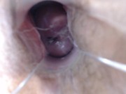 Preview 6 of Speculum Pussy Close up Inside My Pussy