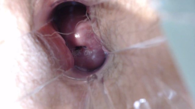 Speculum Pussy Close up Inside My Pussy