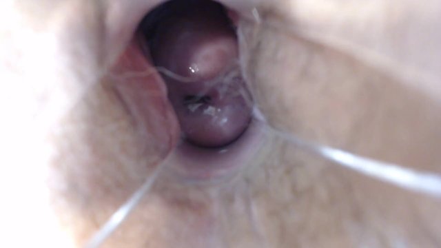 Speculum Pussy Close up Inside My Pussy