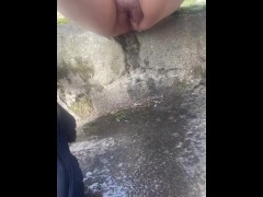 I can’t hold my pee!!