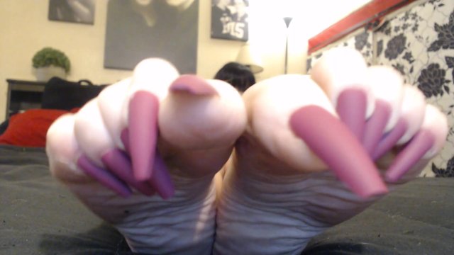 Extremely Long Toenails  Wrinkled Soles