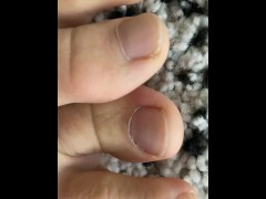 Extremely close view for my natural toenails