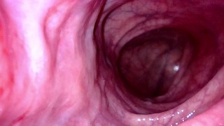 POV - Neem een kijkje om de hoek van mijn transversale colon