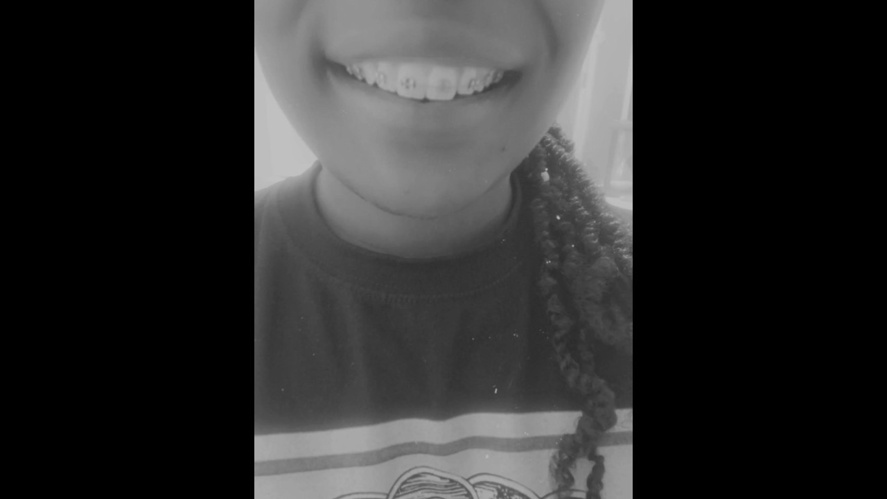 Brace Face Brat - Pornhub.com