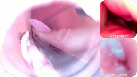 Camera Inside Real Vagina Before & After Creampie - Cervix POV