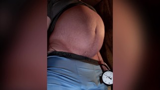 Neue Beleuchtung - Belly Inflation