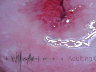 Пульс шейки матки, сердцебиение, оргазмы, ЭКГ - Sophie Adulting
