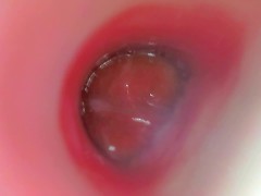 Camera Inside Pink Pussy Records A Huge Creampie From Within (Slow Motion Cumshot)