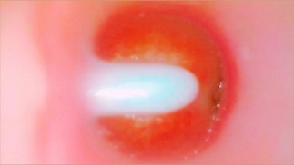 Camera Inside Pink Pussy Records A Huge Creampie From Within (Slow Motion Cumshot)
