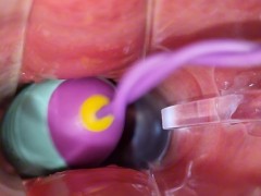 vibrating egg in vagina opened by speculum causes intense orgasms