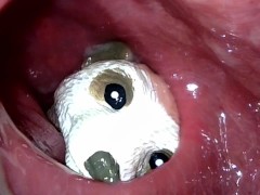 Meerkat toy sinking deep into my descending colon