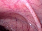 Preview 1 of Take in the view peering up my descending colon