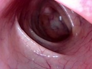 Preview 3 of Take in the view peering up my descending colon