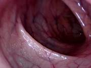 Preview 4 of Take in the view peering up my descending colon