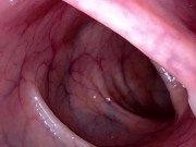 Preview 5 of Take in the view peering up my descending colon