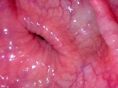 Take in the view peering up my descending colon