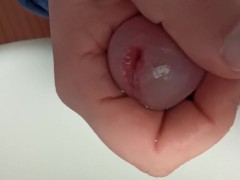 peehole enlargement while peeing