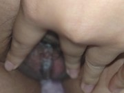 Preview 3 of Vaginal discharge entangled in Japanese women's pubic hair.