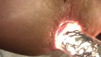 Lighting Up My Ass