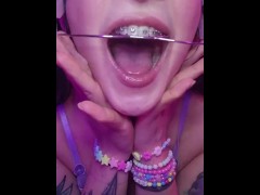 Headgear Lens Licking Spit Uvula Countdown Braces