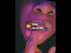 Braces update!!!!!!! - Screenshot 11 of 16 - Bratty Sis